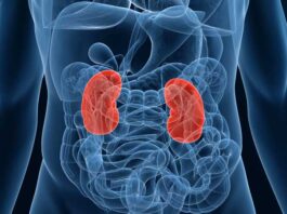 End-Stage Renal Disease (ESRD)