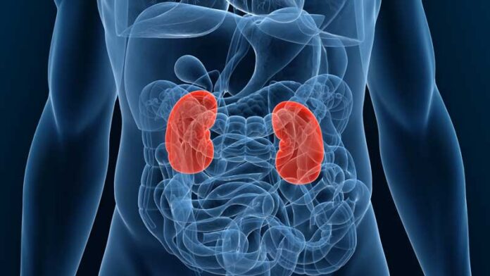 End-Stage Renal Disease (ESRD)