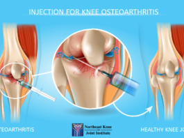 knee gel injections near me